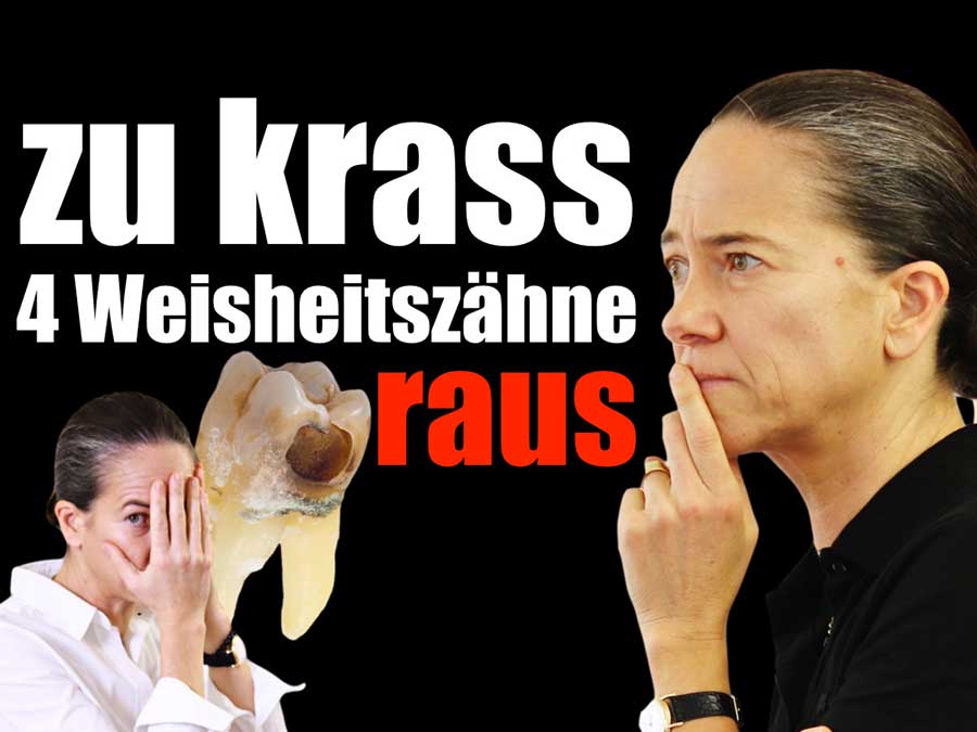 Vier-Weissheitszaehne