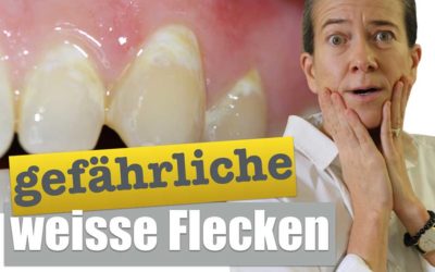 FLECKEN AUF ZÄHNEN DIE SCHOCKIERENDE WAHRHEIT