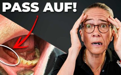 DARUM verlierst du deine Zähne… – Einblicke in 2 fatale Fehler