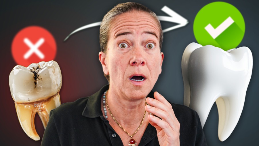 Karies-Zahnfleischprobleme